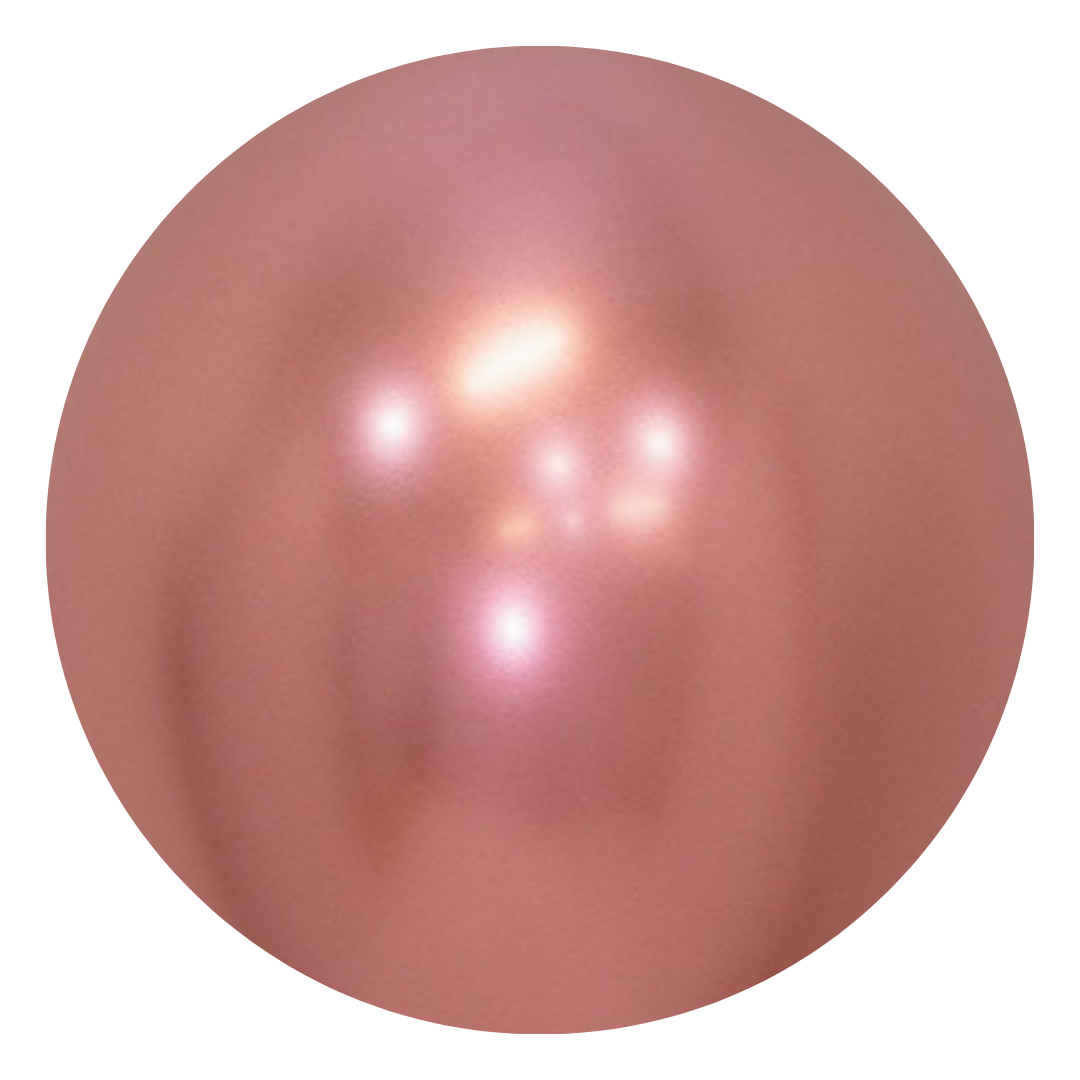 Reflex Rose Gold